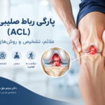 پارگی رباط صلیبی زانو (ACL)؛ علائم، تشخیص و درمان